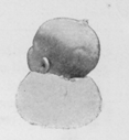 Baby's head from behind.